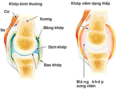 Cá basa bổ huyết, giảm đau nhức